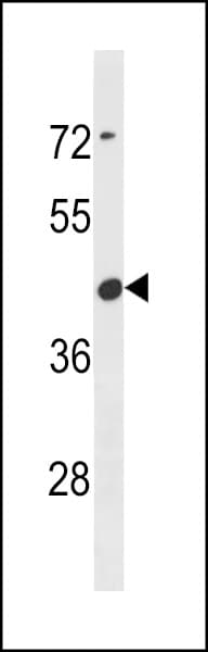 Polyclonal Rabbit anti-Human CBWD6 Antibody (aa193-221, WB)