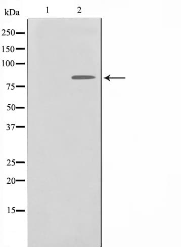 NBN / Nibrin Antibody