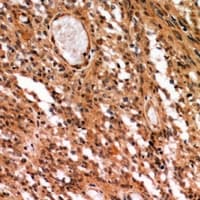 Polyclonal Rabbit anti-Human GNAI2 Antibody (IHC, WB)