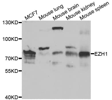 Polyclonal Rabbit anti-Human EZH1 / ENX-2 Antibody (IHC, IF, WB)