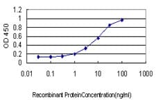 IHC-plus™ HIP1 Antibody (clone 1F12)