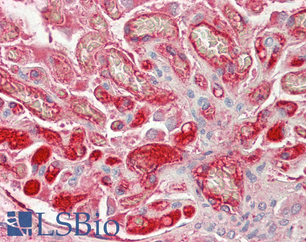 IHC-plus™ FGB / Fibrinogen Beta Chain Antibody (aa177-190)