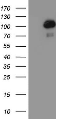 PR / Progesterone Receptor Antibody (aa1-298, clone OTI20A1)