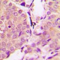 SNCA / Alpha-Synuclein Antibody (C-Terminus)