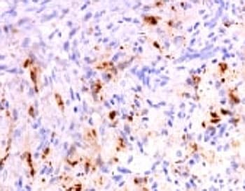 TNF Alpha Antibody (aa115-130, clone SPM543, Azide-free, BSA-free)