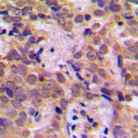 NFKB1 / NF-Kappa-B Antibody (phospho-Ser932)