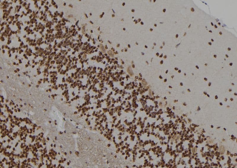 APP / Beta Amyloid Precursor Antibody