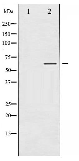 TH / Tyrosine Hydroxylase Antibody (phospho-Ser40)