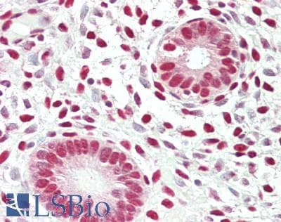 IHC-plus™ DDX1 Antibody (aa650-C-term)