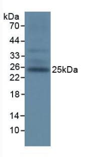 TIGIT Antibody (aa28-246, Cy3)