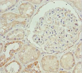 Polyclonal Rabbit anti-Human ETFA Antibody (IHC, WB)