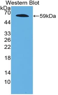 FBN2 / Fibrillin 2 Antibody (aa1550-1791)
