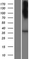 SLC22A20 Protein (Over-Expression Lysate Myc-DDK (Flag))