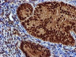 Monoclonal Mouse anti-Human EPM2AIP1 Antibody (clone OTI2A2, IHC, WB)
