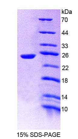 Human PTPRU Protein (Recombinant His, N-Terminal)