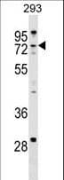 ZCCHC8 Antibody (aa560-590)