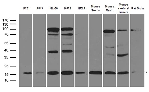 UBE2L3 / UBCH7 Antibody