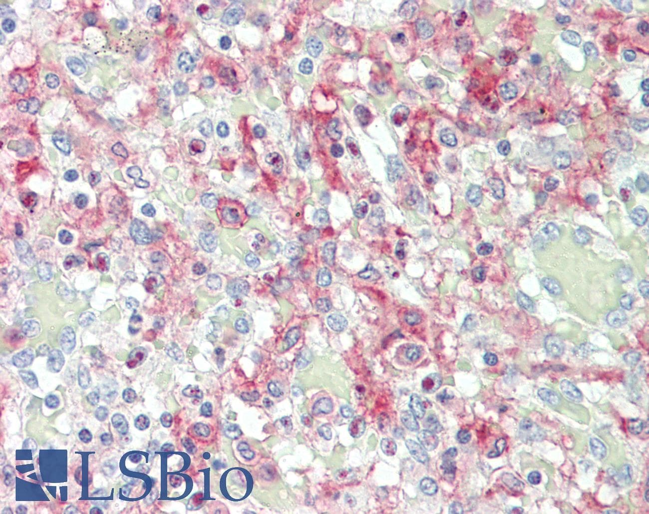IHC-plus™ CD32A Antibody (clone 13D7)