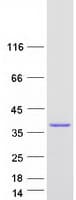 Human MPST Protein (Recombinant Myc-DDK (Flag))