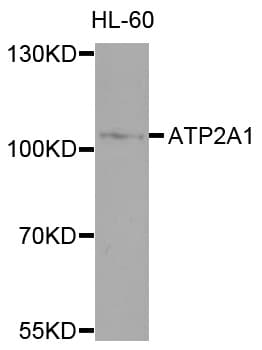 Polyclonal Rabbit anti-Human ATP2A1 / SERCA1 Antibody (WB)