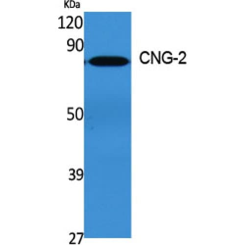 CNGA2 Antibody (360-440 aa, Internal)
