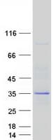 Human CNOT7 Protein (Recombinant Myc-DDK (Flag))