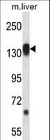 Polyclonal Rabbit anti-Human RPS6KC1 Antibody (aa20-47, IHC, WB)