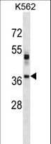 VSX1 Antibody (aa125-154)