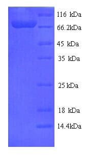 Human FPGT Protein (Recombinant His)