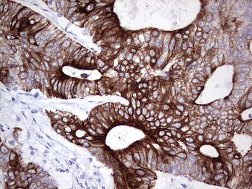 Monoclonal Mouse anti-Human KRT19 / CK19 / Cytokeratin 19 Antibody (clone OTI5F4, aa240-390, IHC, WB)