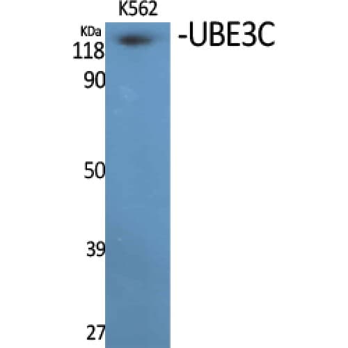 UBE3C Antibody (Internal)