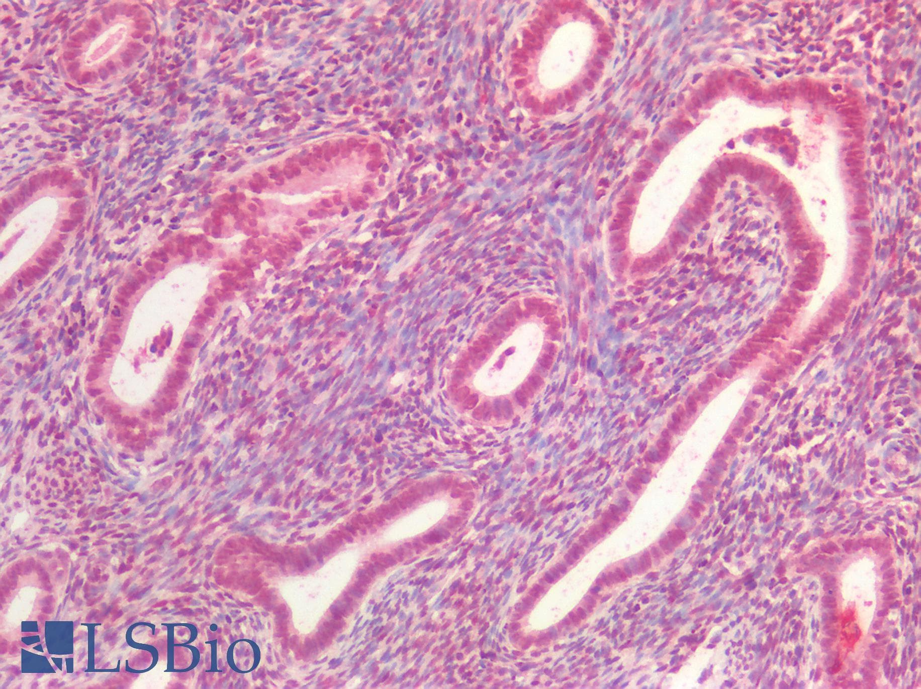 PathPlus™ CDKN1C / p57 Kip2 Antibody