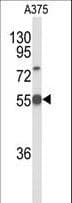 IHC-plus™ Delta3 / DLL3 Antibody (aa519-548)