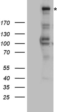 ATR Antibody