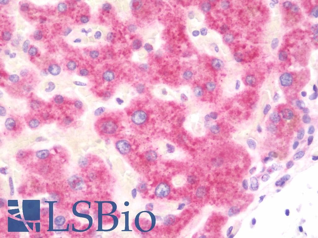 IHC-plus™ Polyclonal Rabbit anti-Human SMPD1 / Acid Sphingomyelinase Antibody (aa391-419, IHC, WB)