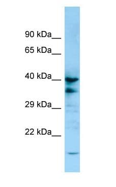 P2Y13 / P2RY13 Antibody (aa278-327)