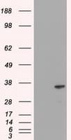 DFFA / ICAD / DFF45 Antibody (clone OTI3F12)