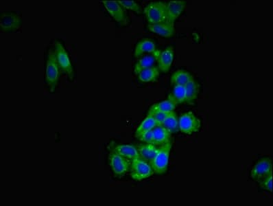 Polyclonal Rabbit anti-Human FAM171B Antibody