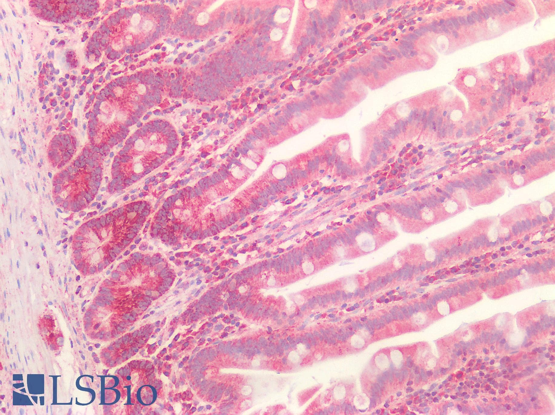 PathPlus™ Polyclonal Rabbit anti-Human HSPA9 / Mortalin / GRP75 Antibody (IHC, IF, WB)