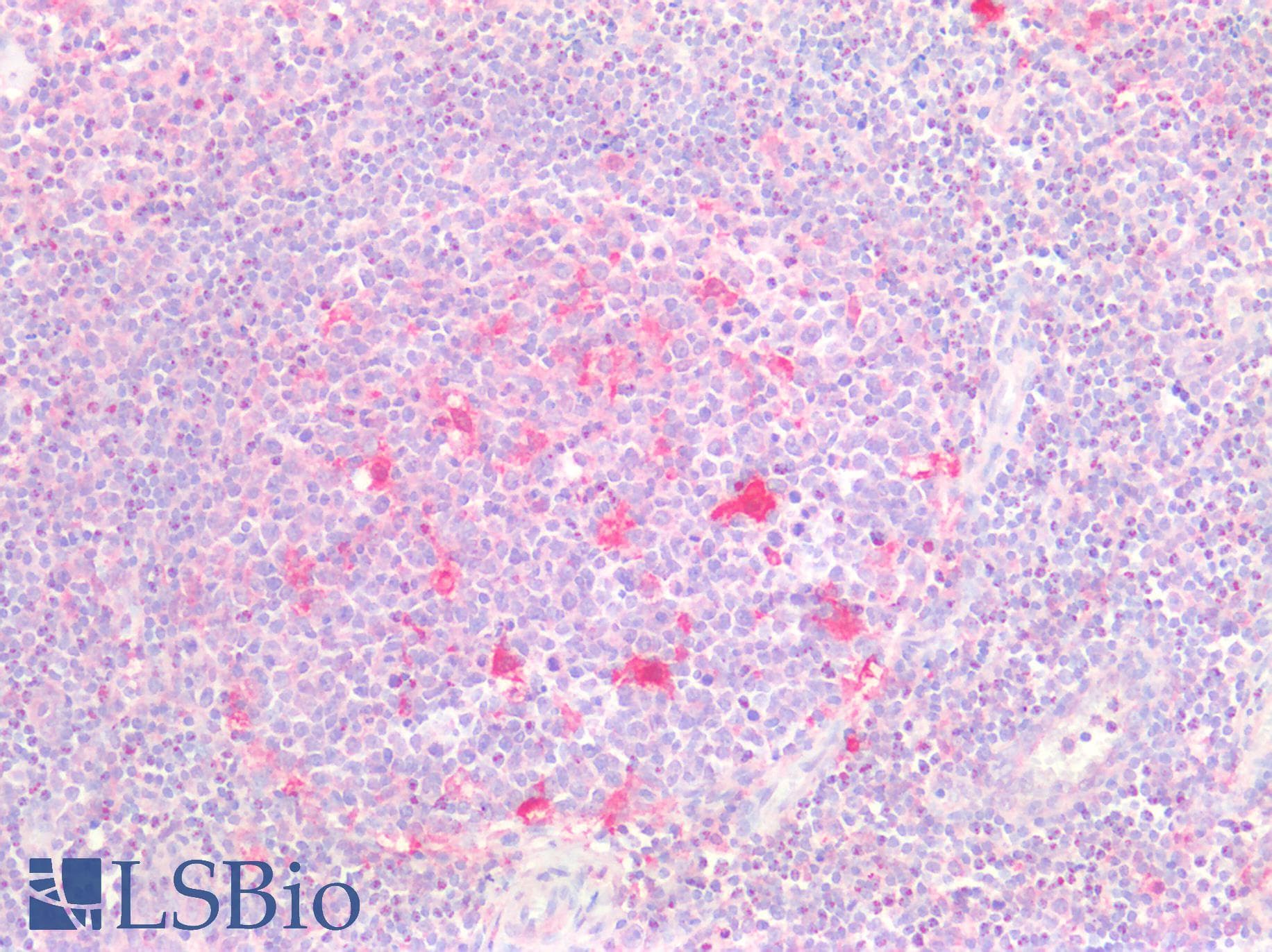 IHC-plus™ TMIGD2 Antibody (clone 8A1)