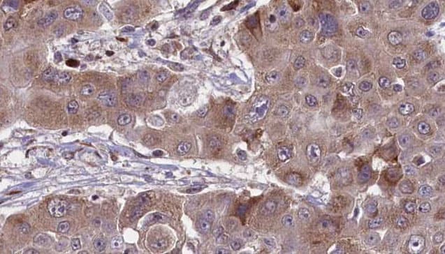 Polyclonal Rabbit anti-Human RHOC Antibody (IHC, WB)