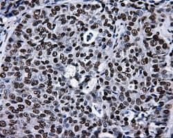 RPA2 / RFA2 / RPA34 Antibody (clone OTI9A1)