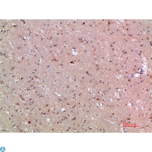 ASCL1 / MASH1 Antibody