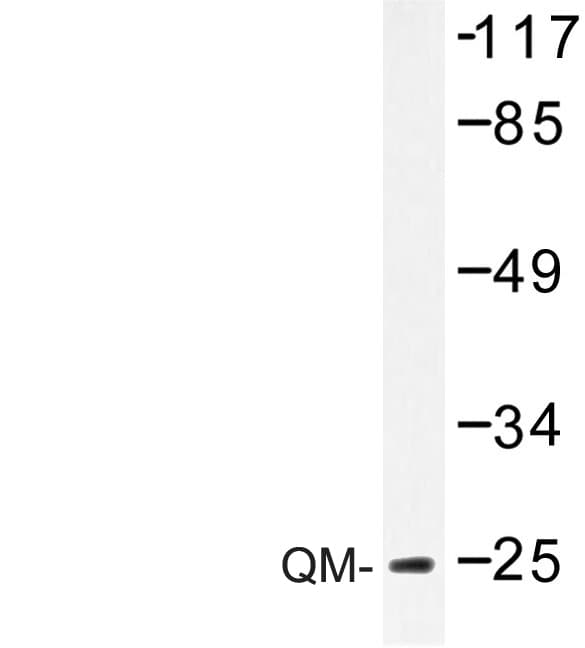RPL10 / Ribosomal Protein L10 Antibody (Phe34)