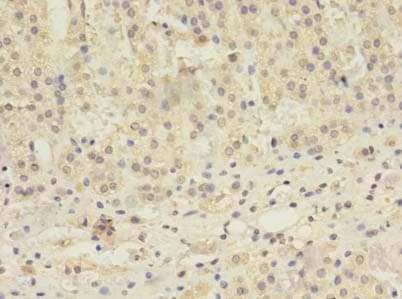 TBC1D20 Antibody