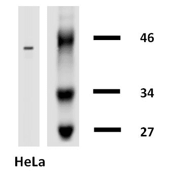 KRT18 / CK18 / Cytokeratin 18 Antibody (clone DA-7, Biotin)