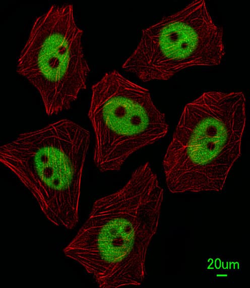 XRCC1 Antibody (aa407-435)