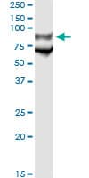 Monoclonal Mouse anti-Human GP1BA / CD42b Antibody (clone 1C6, WB)