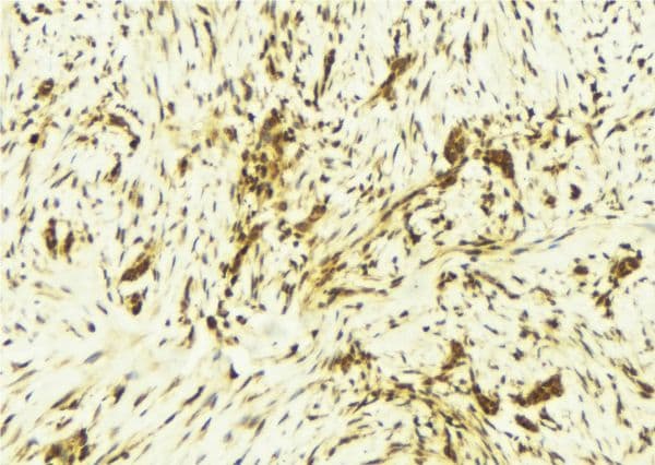 STAT1 Antibody