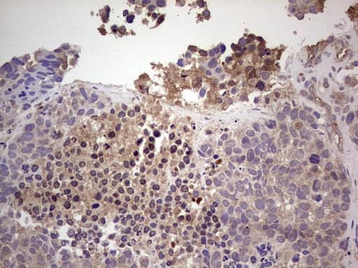 Monoclonal Mouse anti-Human RET Antibody (clone OTI4H3, aa713-1017, IHC, WB)